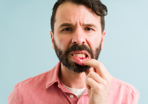 Symptoms of gum disease