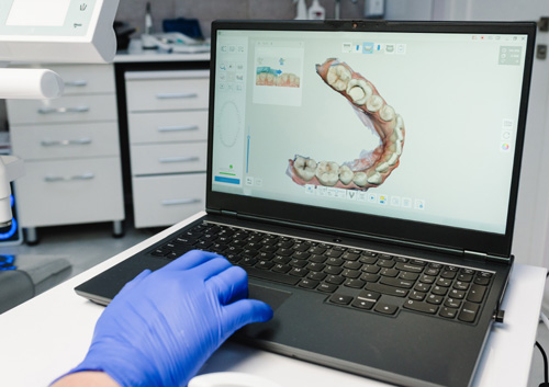 dentist scanning teeth on a laptop