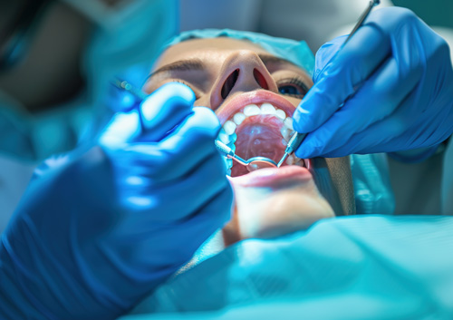 tooth extraction